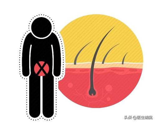 女性*处私**毛毛太密，能刮掉吗？医生说出实话，看完再做决定