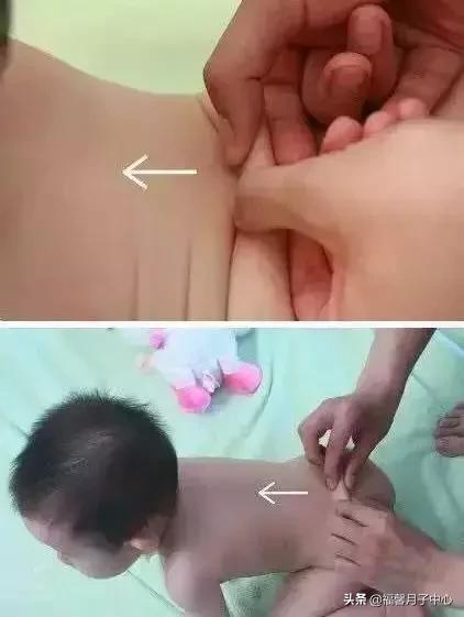 小儿推拿便秘咳嗽,小儿推拿积食通便