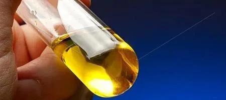 尿常规中白细胞123,尿检白细胞118多严重吗