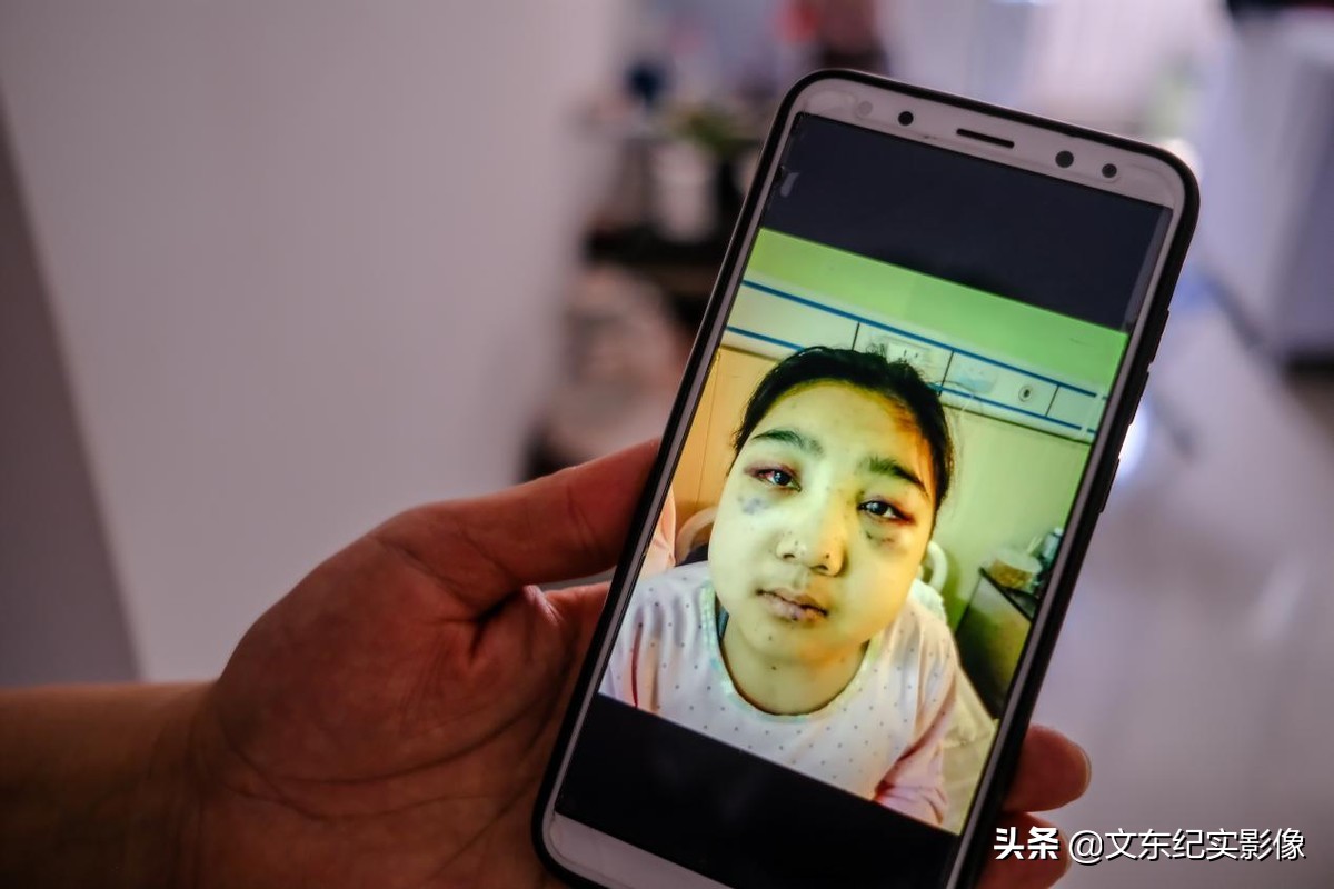 大头娃娃目前能治好吗,大头娃娃患病的原因是