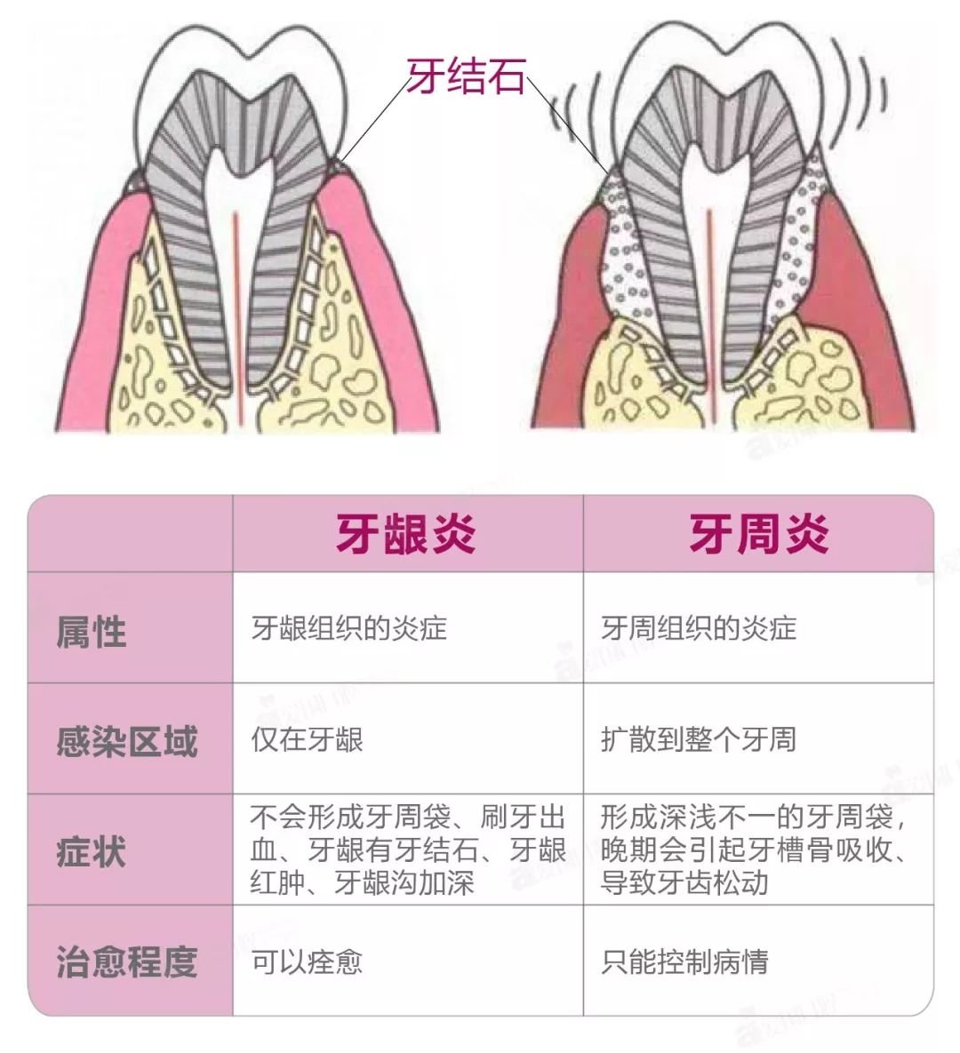 牙齿生病的各种症状,牙齿有什么严重的病