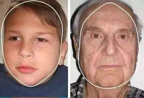 面部衰老改善最好的方法,衰老与面部轮廓的变化