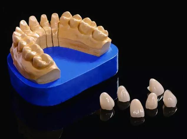 死髓牙是什么,死牙和种植牙的区别