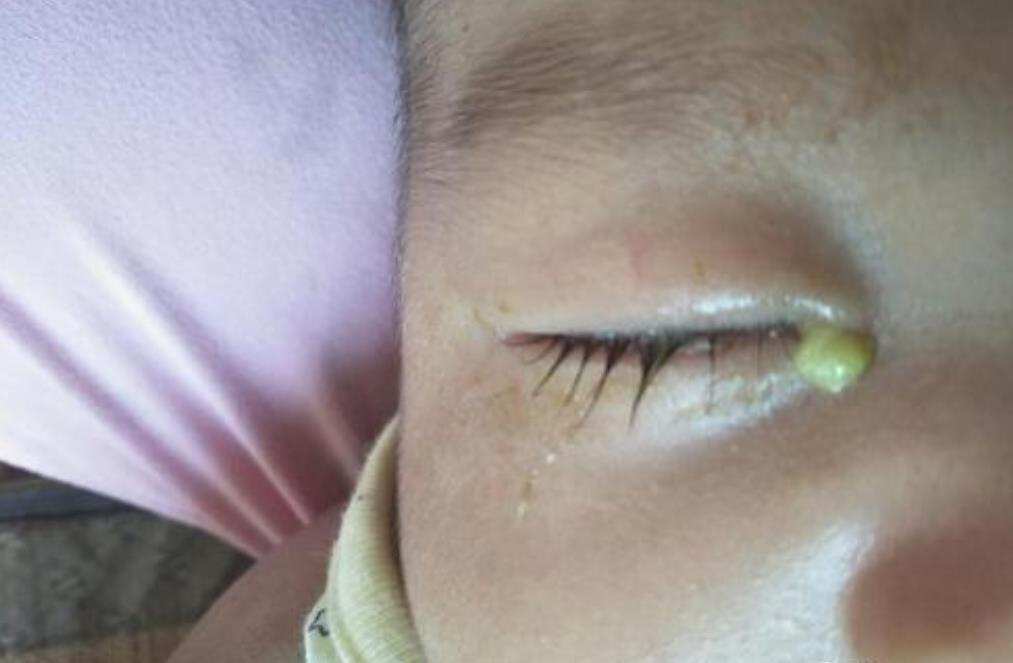 月子喝水用什么奶瓶,坐月子孕妈要不要多喝水