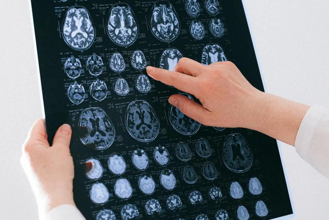 21个月宝宝突然发烧40度,50岁突然发烧40度怎么办