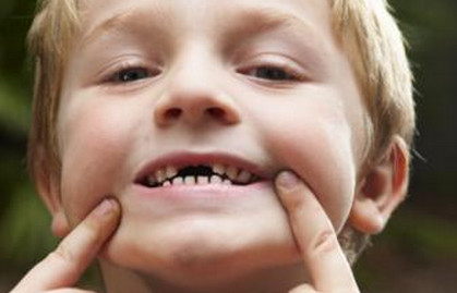 儿童一颗恒牙长一半很久不长了,19岁乳牙不掉不长恒牙的危害