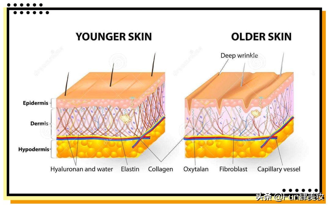 痘印痘坑真正祛除的方法,痘印痘坑去不掉怎么办