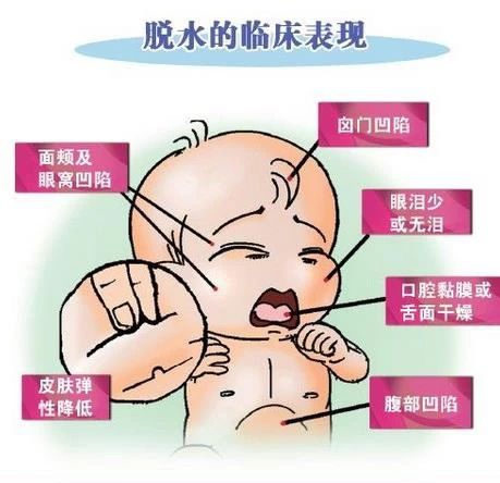 腹泻治疗的4大原则有哪些,急性腹泻的临床表现及治疗原则