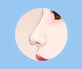 鹰钩鼻与哪种鼻子很相似,箭头鼻和悬胆鼻