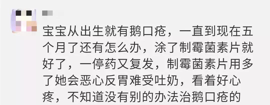 鹅口疮和奶垢的最有效的辨别方法,哺乳期宝宝鹅口疮最佳治疗方法