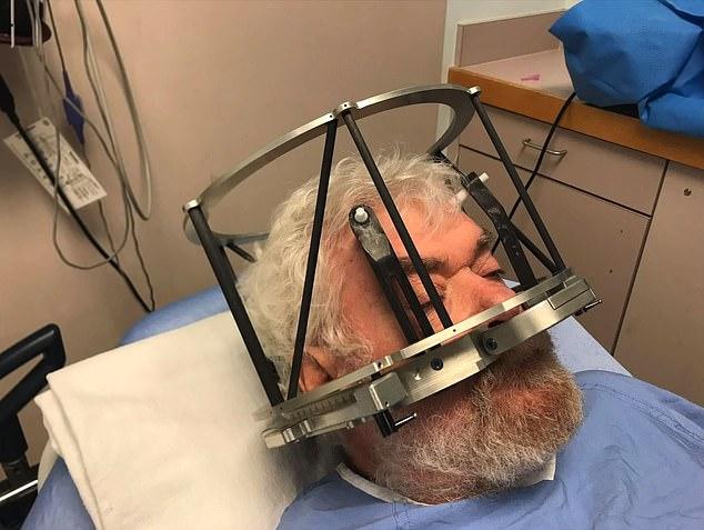 加拿大科学家提出在脑中植入电极治疗酗酒，67岁医生成功戒掉酒瘾