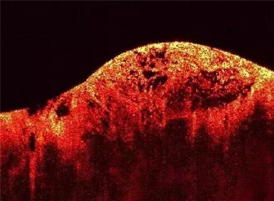 几分钟让你明白翡翠原石赌石知识,赌石必看翡翠赌石里隐藏的陷阱