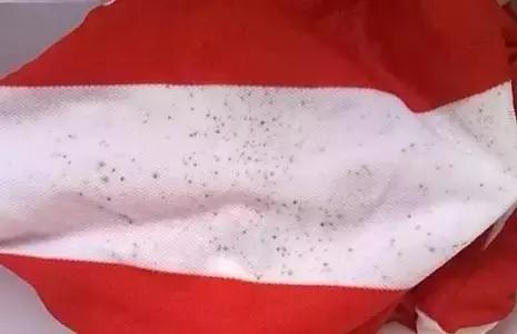 怎样去除衣物上的霉味霉斑和黑点？