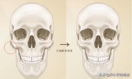 高颧骨女星为什么也好看,高颧骨女生好不好