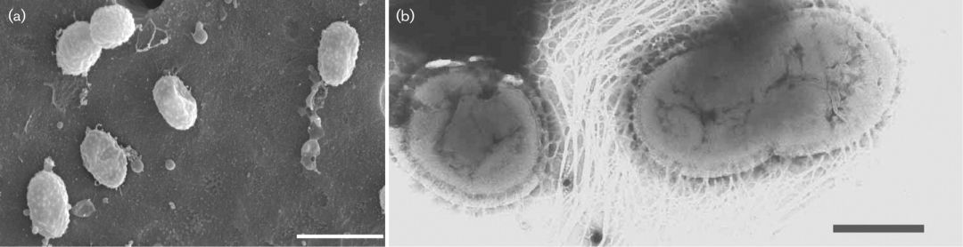 利用宿主分泌的粘蛋白“为食”的Akk菌