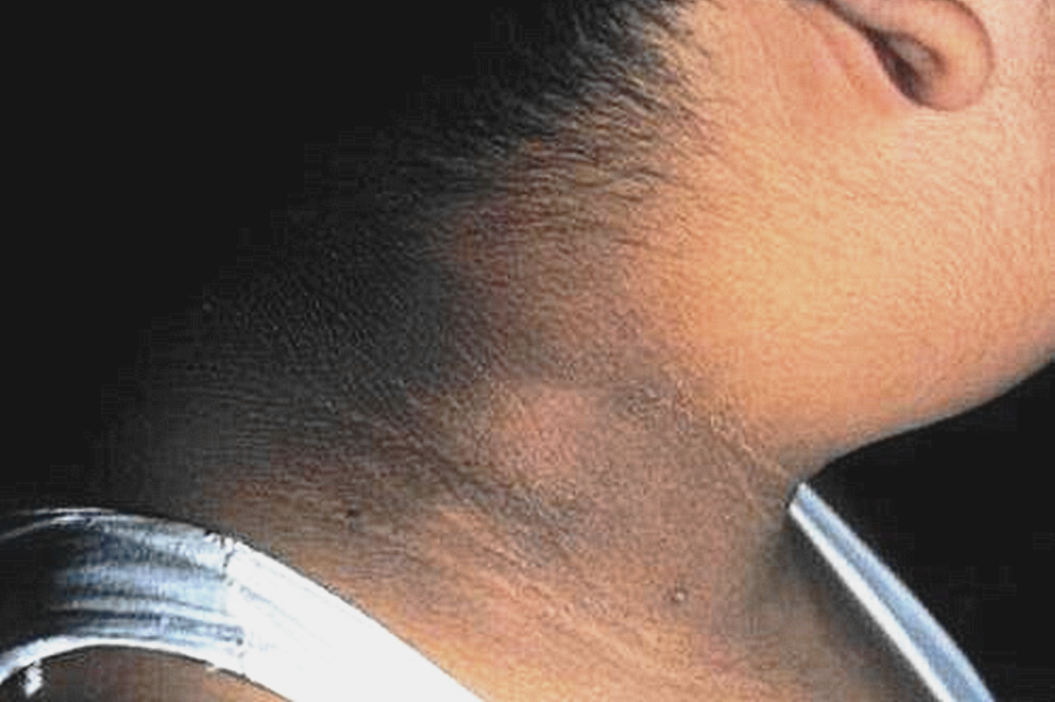 小孩脖子黑拿什么洗好,儿童脖子发黑洗不掉视频