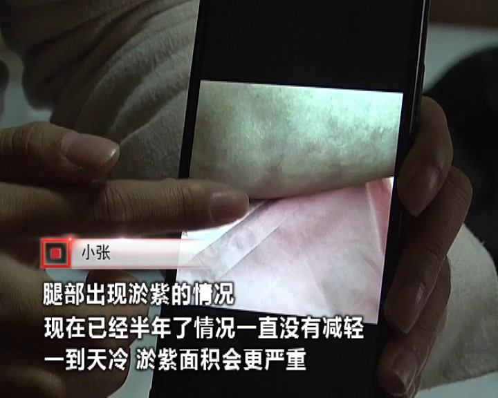 女子抽脂术后皮肤坏死,抽脂后身上掉皮