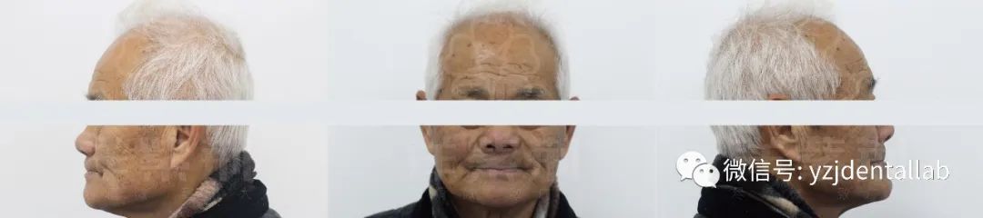 病例教学视频,病例分析操作技能