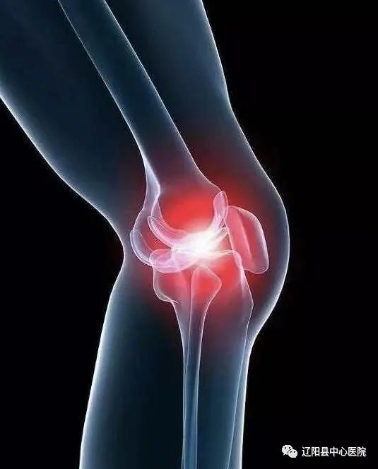 夏天膝关节冷疼怎么治疗,膝关节疼痛的健康宣教