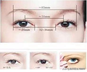 眼睛手术的坑,不要往里面跳了