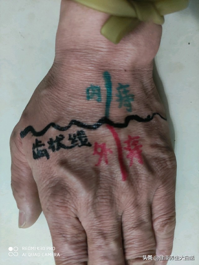 得了痔疮不用怕教你一招轻松解决,得了痔疮怎么治好得快啊