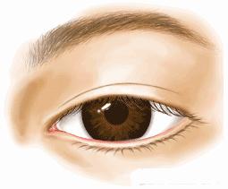 不建议做双眼皮的三种情况,为什么不建议做双眼皮