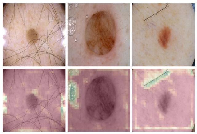 浅谈医学影像技术,医学图像分析深度学习模型