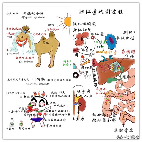 医学漫画视频|眼干、口干不是小事，小心干燥综合征