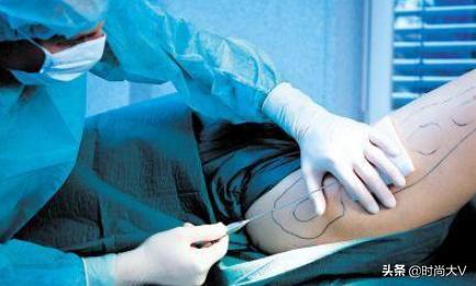 为什么不建议做抽脂,为什么不建议抽脂手术