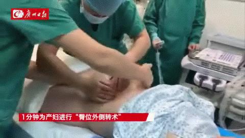 胎位不正乾坤大挪移视频,医生妙手10秒转胎头助力顺产