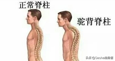 含胸驼背不怕，2个面墙动作，帮你纠正