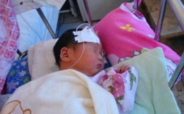 婴儿身上长黑刺家里老人非要去刮,小孩身上出现小黑刺