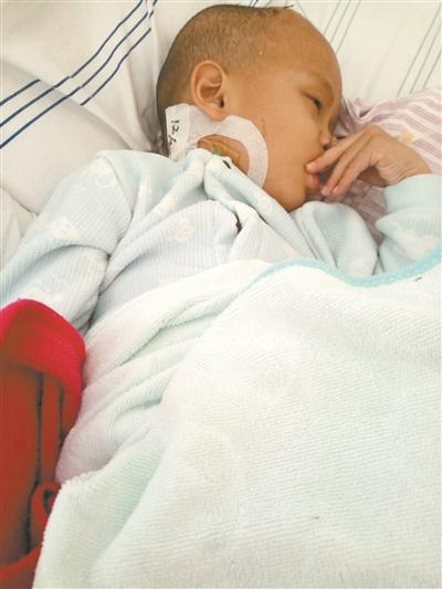 12岁男孩脑瘤术后康复,脑瘤术后暴瘦