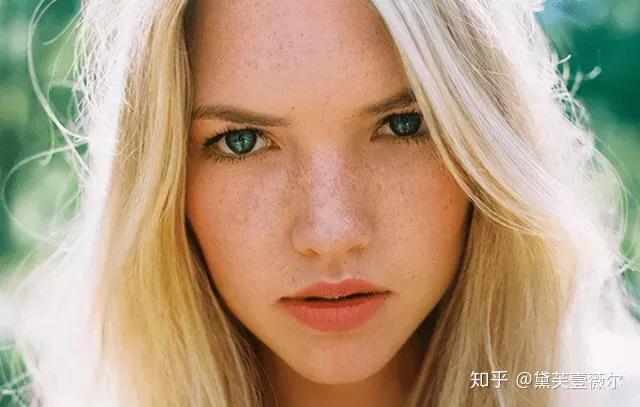 雀斑是什么原因引起的可以去掉吗,雀斑的形成原因及去除方法