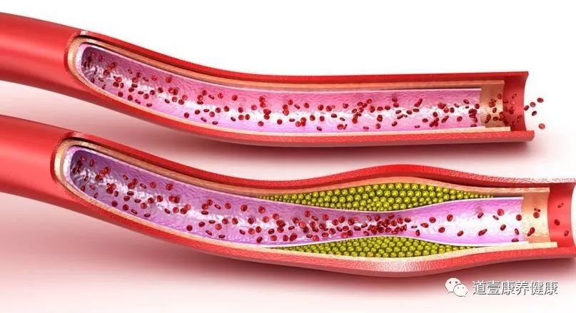 指甲根部凹陷不平整,指甲凹陷不平是什么原因