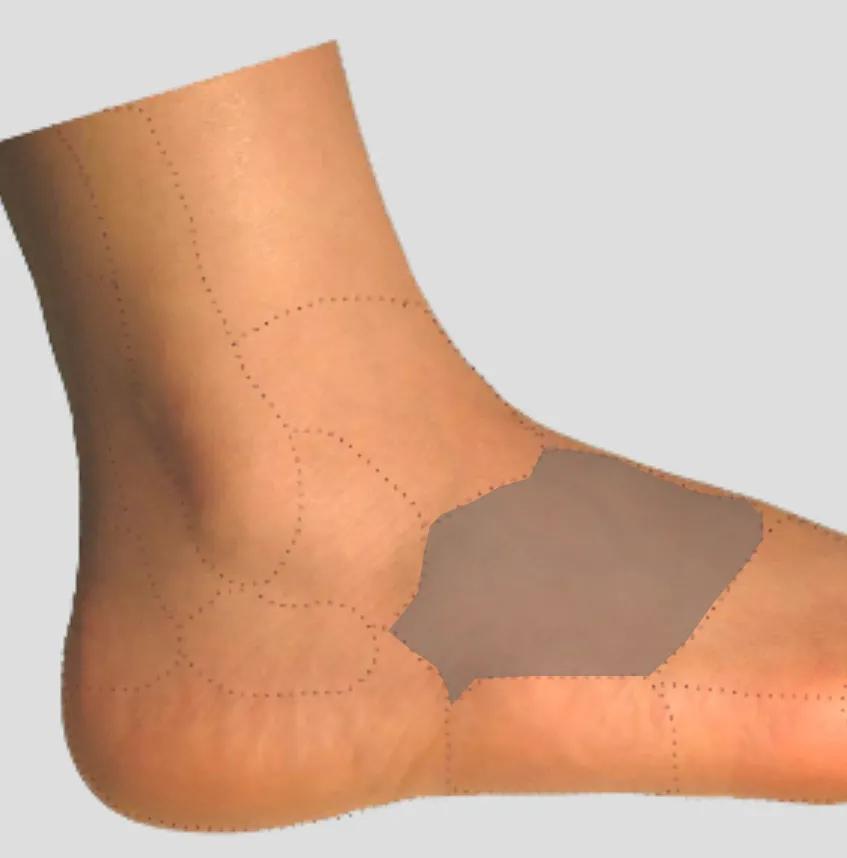 足踝外侧疼痛部位对照表,足踝外侧疼痛的处理方法