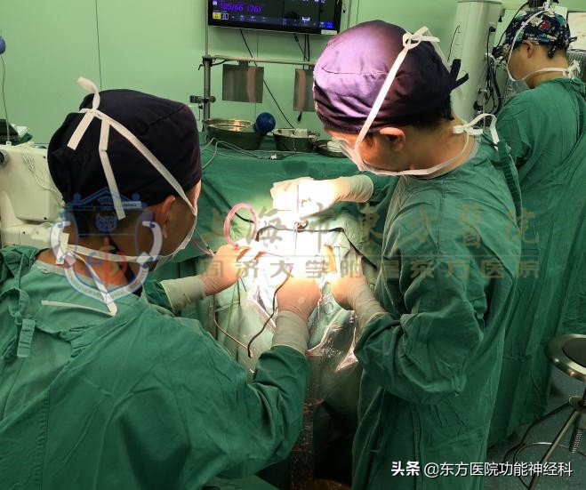 怎么才能让精神分裂症病人听话,早期发现精神分裂症怎么开导