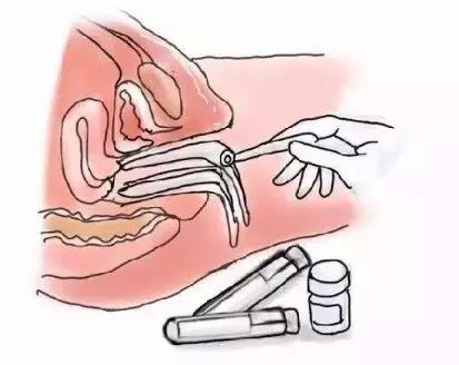 子宫“问题百出”,妇科检查到底做哪些?