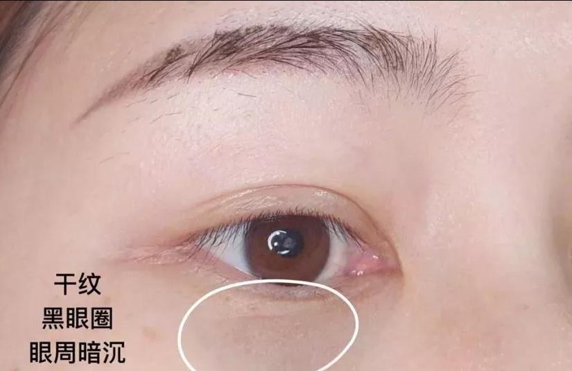 雅诗兰黛小棕瓶对比兰蔻菁纯眼霜,雅诗兰黛小棕瓶眼霜与兰蔻小黑瓶