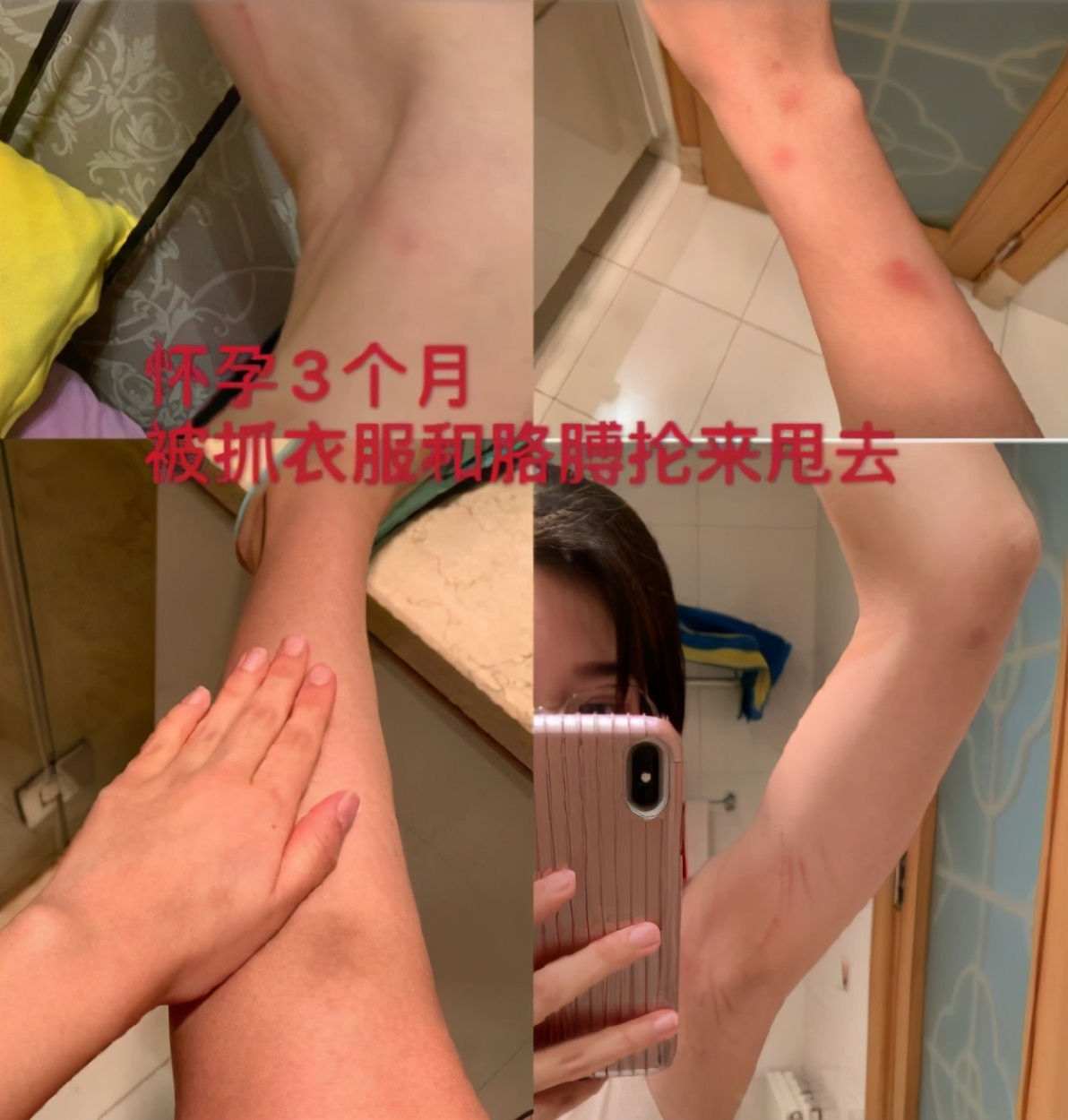 张培萌家暴真实原因,张培萌首度回应家暴事件