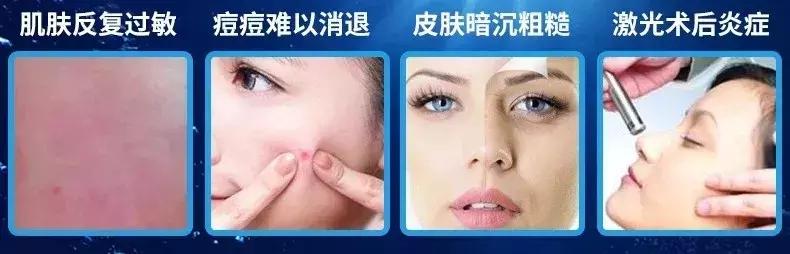 医用敷贴面膜和普通面膜的区别,医用面膜跟普通面膜有什么区别