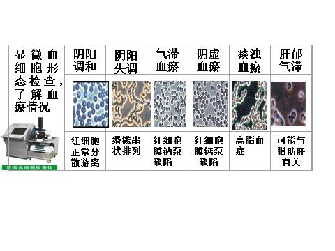 远离亚健康人群,远离亚健康疾病