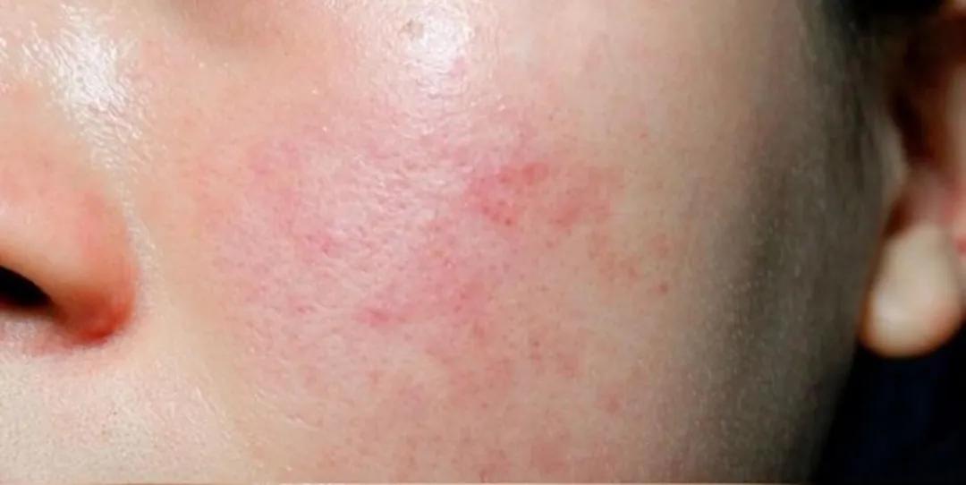 圣璐嘉兰护肤品,护肤品为什么要品牌的