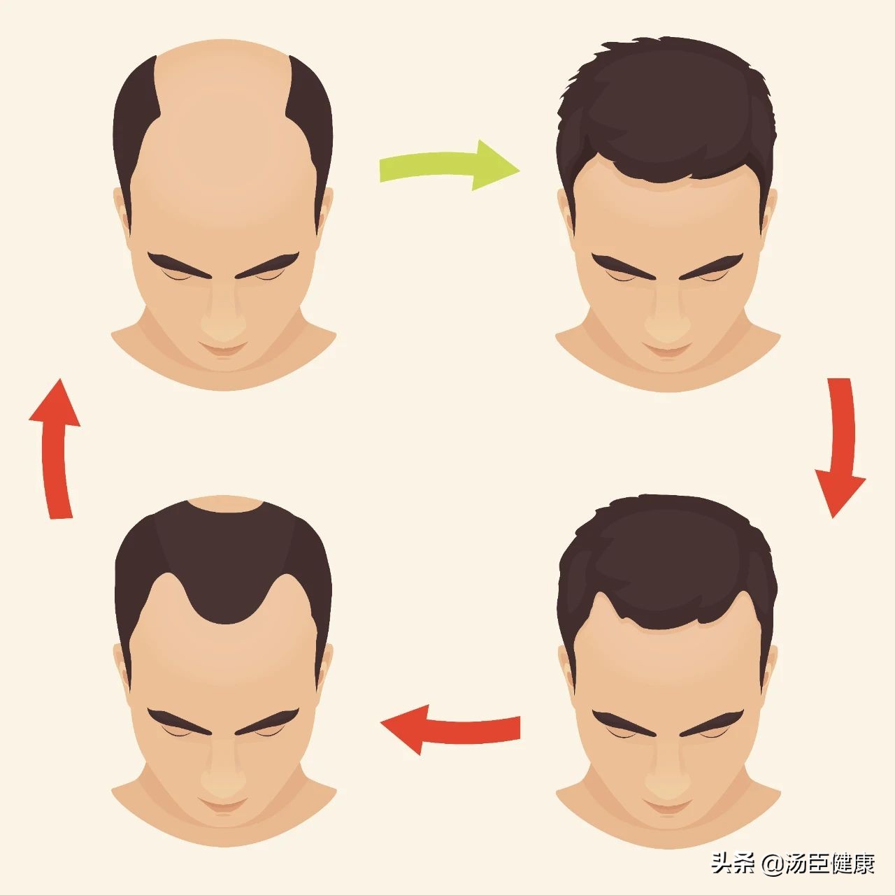 坚持健身半年居然秃了,20岁小伙子坚持健身半年竟然秃了