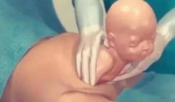 剖腹产仅仅“挨一刀”就完事了？看完四张图，谁说简单和谁急