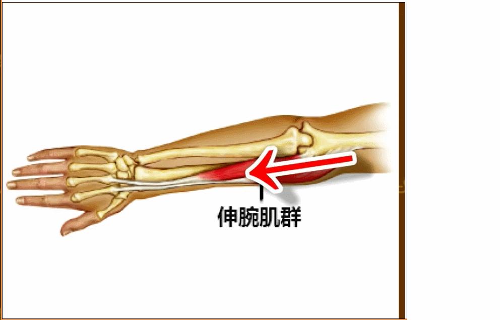 网球肘能自我恢复吗,网球肘病因的解剖学研究