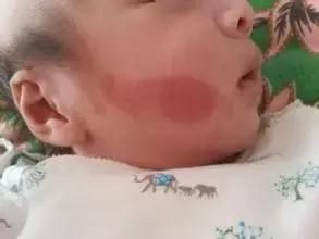 宝宝屁股上的青色印记是怎么回事,宝宝屁股上有青斑是怎么回事