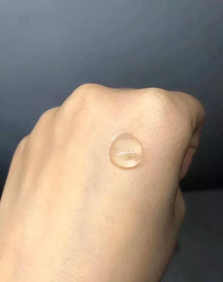 鎬庢牱璋冪悊鐨偆鏆楅粍,渚跨鐨偆鏆楅粍鎬庝箞璋冪悊