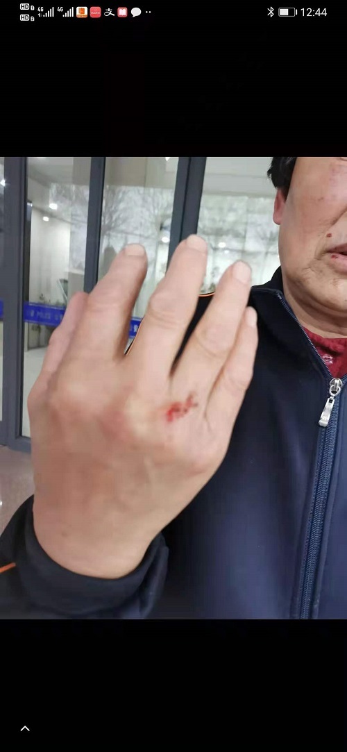 男子突发脑溢血山东,山东男子突发脑出血被遗弃后续