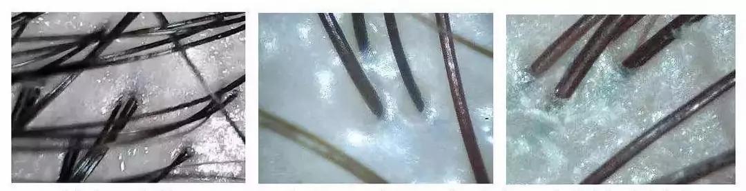 明星亲测|康王创始人83岁再出山，挑战5天内不洗头